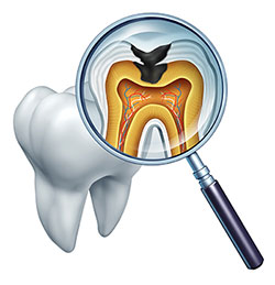 An illustration of a magnified tooth with an internal view showing the pulp chamber and root canals, accompanied by a magnifying glass and a dental X-ray.