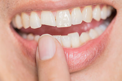 The image shows a person with a wide smile displaying a set of white teeth, holding a toothbrush near their mouth.