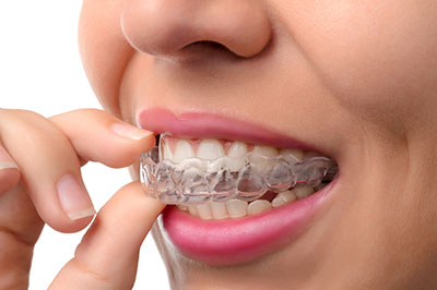 The image shows a person holding a toothbrush with braces on their teeth, emphasizing dental hygiene practices.