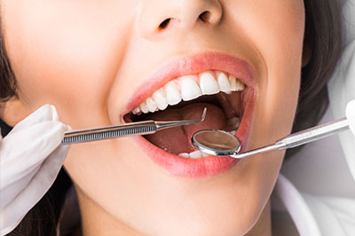 A woman with a wide smile holds her mouth open while a dental hygienist works on her teeth using instruments.